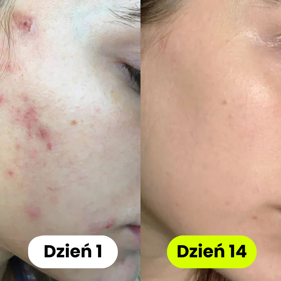 iskin - Słuchawka Prysznicowa z Filtrem