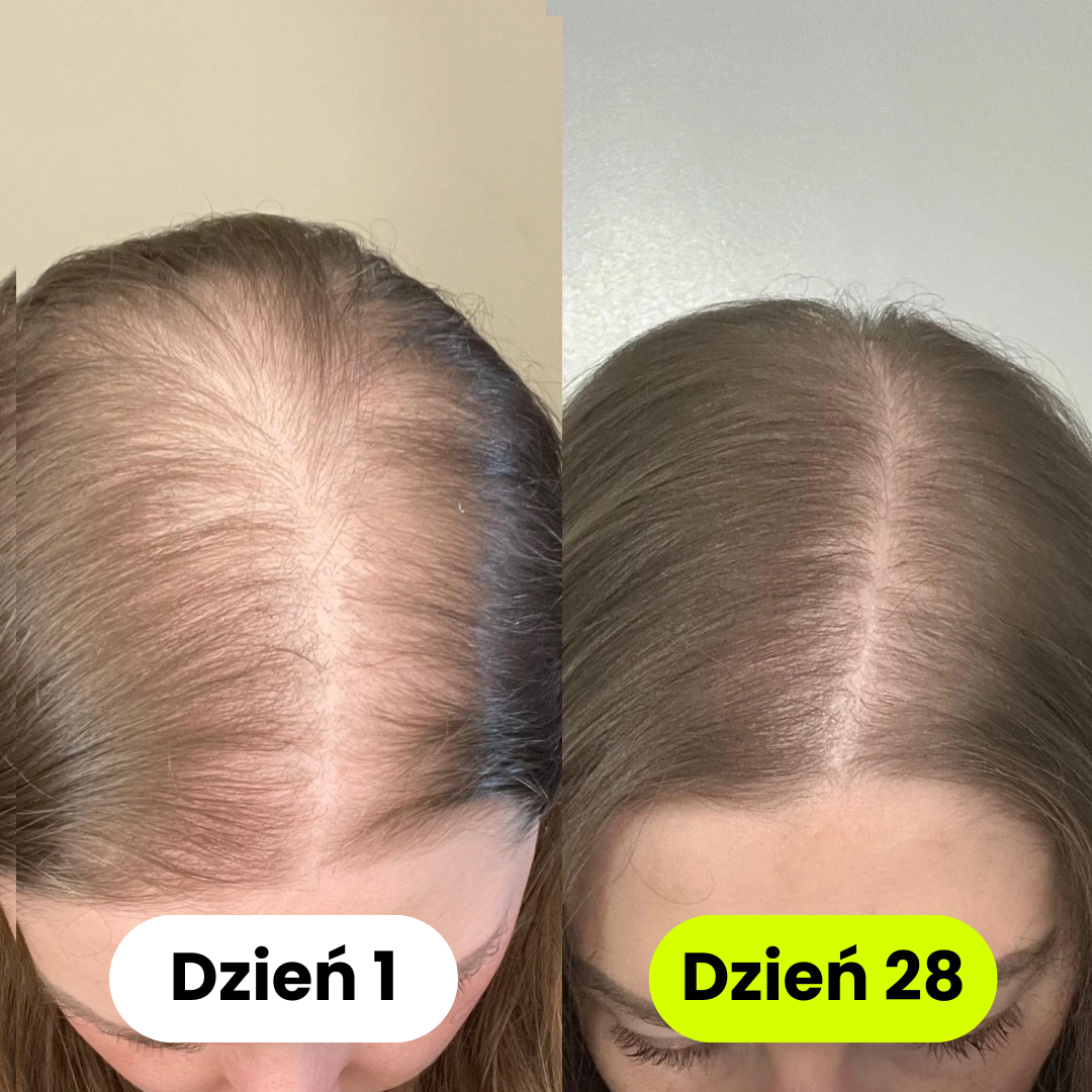 iskin - Naścienna Słuchawka Prysznicowa z Filtrem