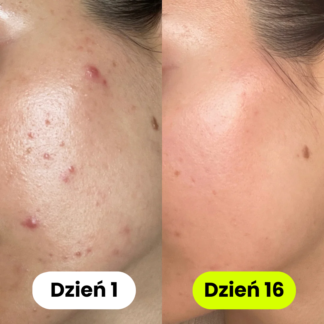 iskin - Słuchawka Prysznicowa z Filtrem