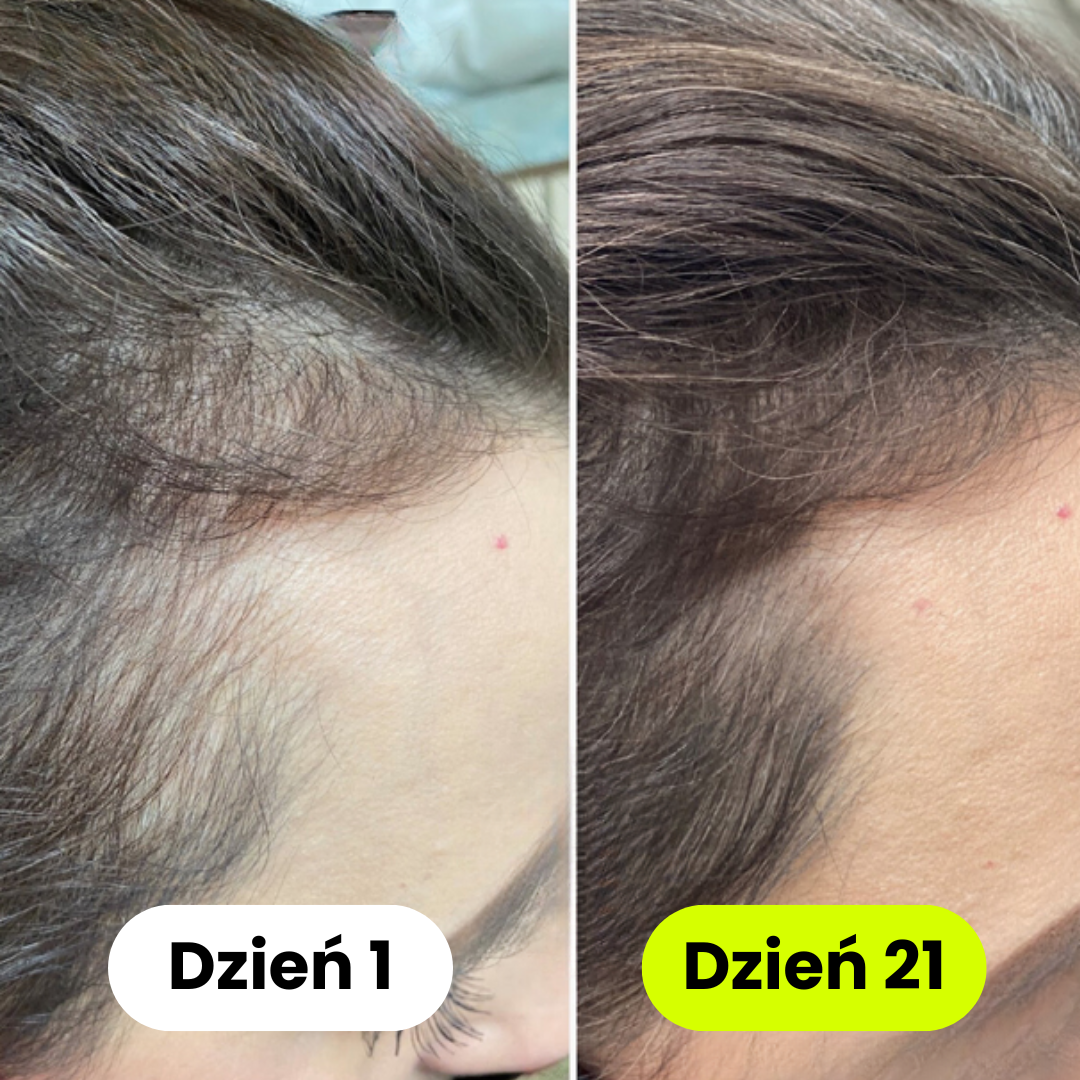 iskin - Słuchawka Prysznicowa z Filtrem