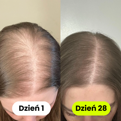 iskin - Słuchawka Prysznicowa z Filtrem